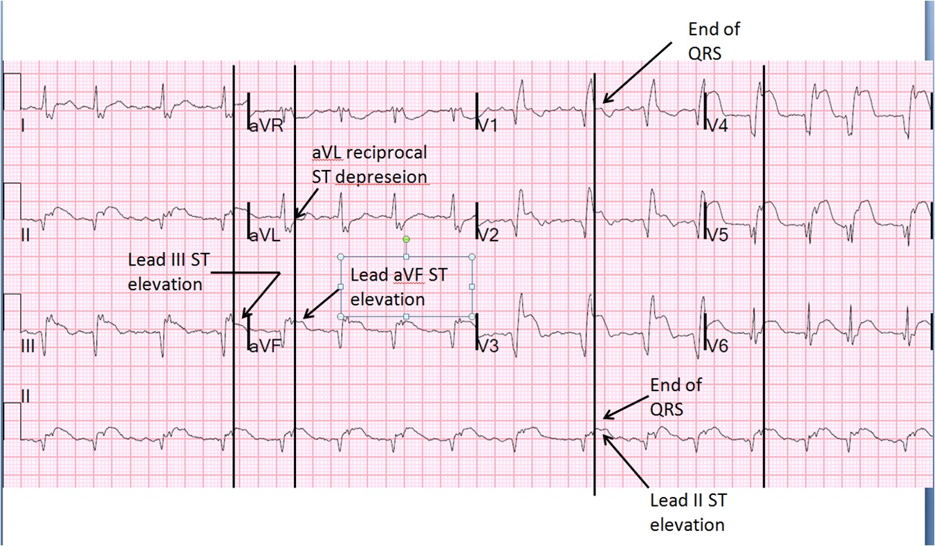 July Pulse Physiology Learning Through Social Education